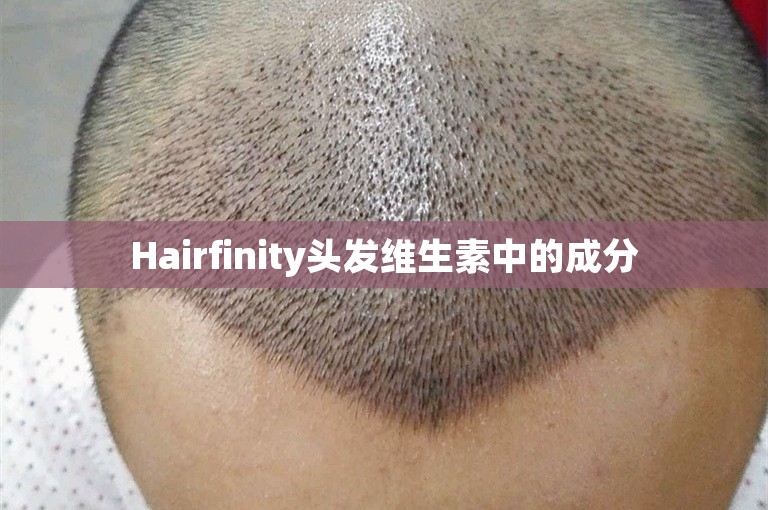 Hairfinity头发维生素中的成分