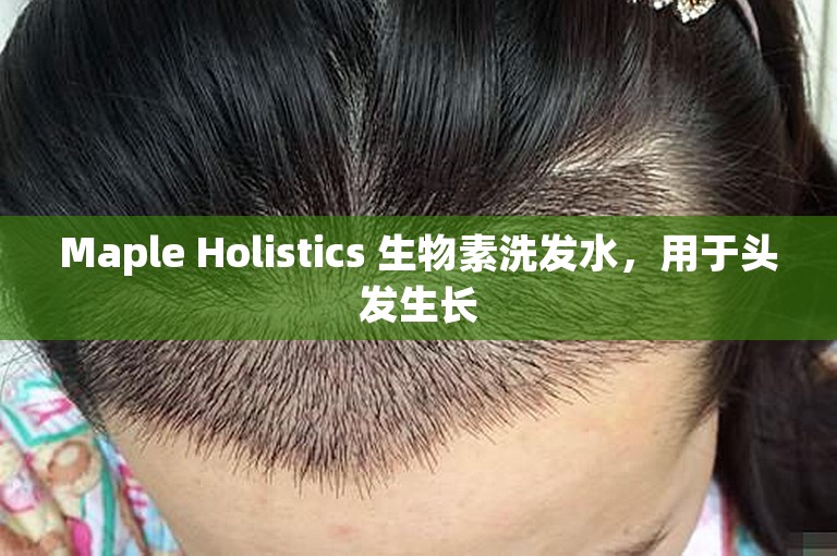 Maple Holistics 生物素洗发水，用于头发生长