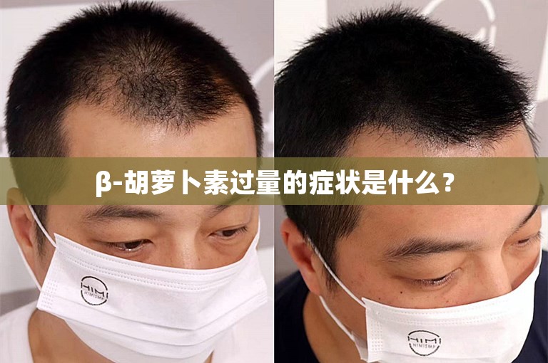 β-胡萝卜素过量的症状是什么？