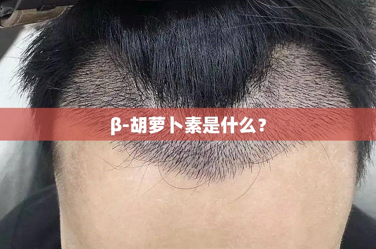 β-胡萝卜素是什么？