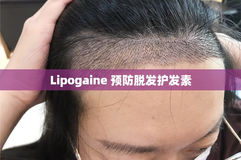 Lipogaine 预防脱发护发素