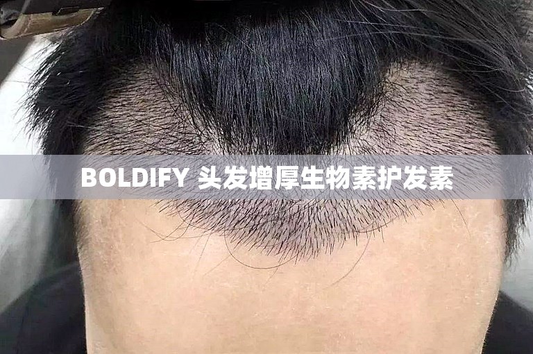 BOLDIFY 头发增厚生物素护发素