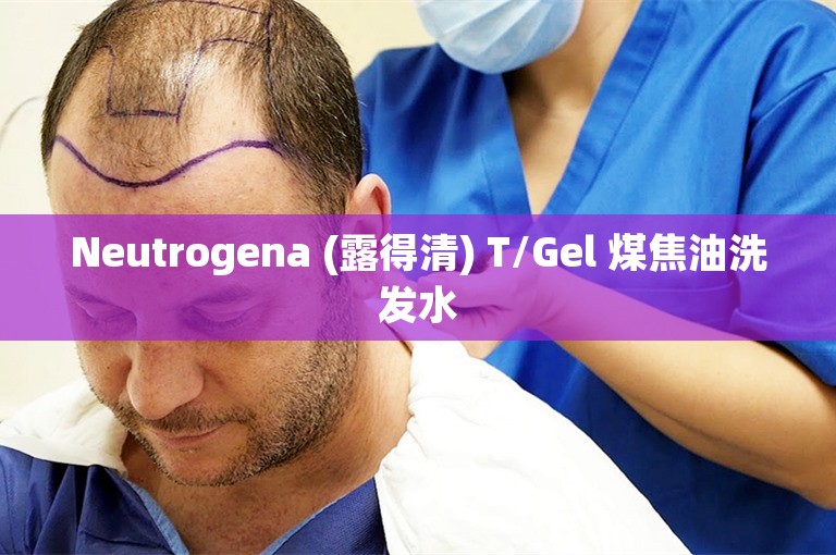 Neutrogena (露得清) T/Gel 煤焦油洗发水