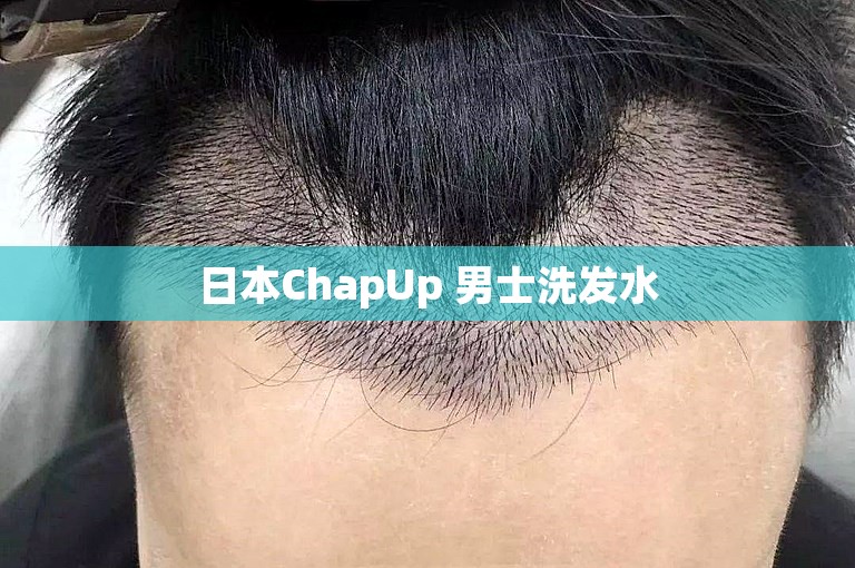 日本ChapUp 男士洗发水