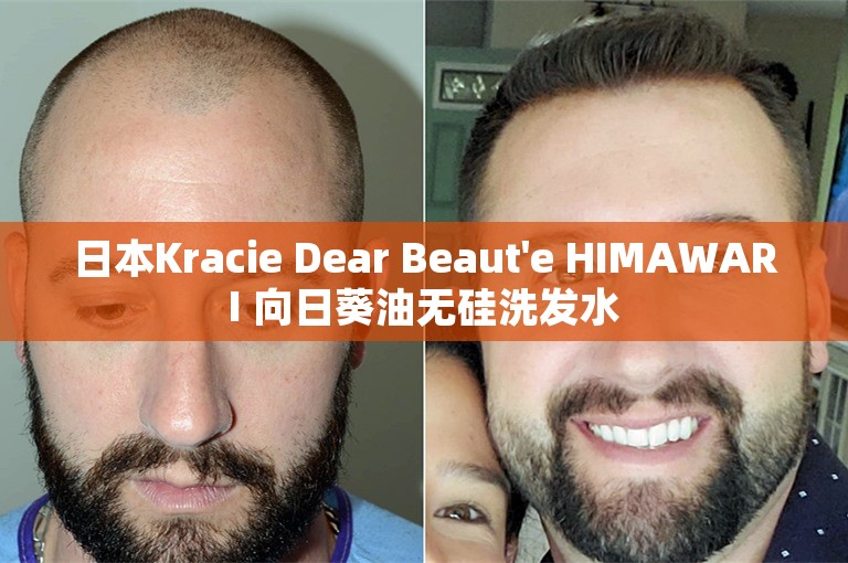 日本Kracie Dear Beaut'e HIMAWARI 向日葵油无硅洗发水