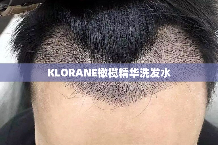 KLORANE橄榄精华洗发水