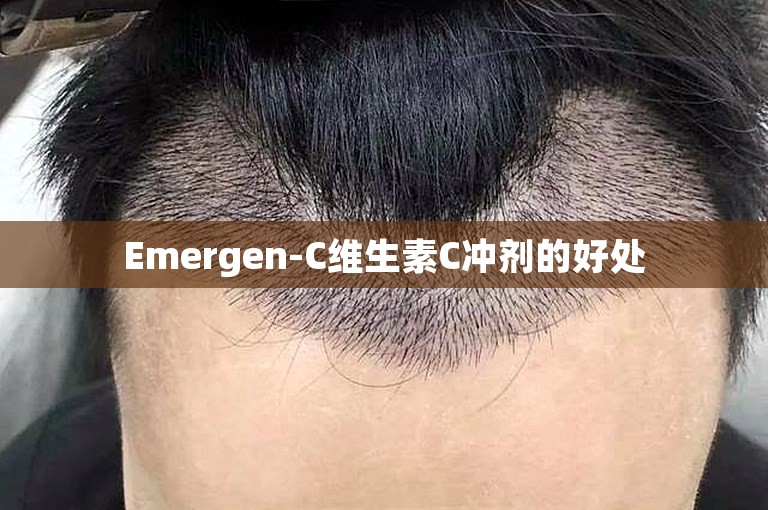 Emergen-C维生素C冲剂的好处