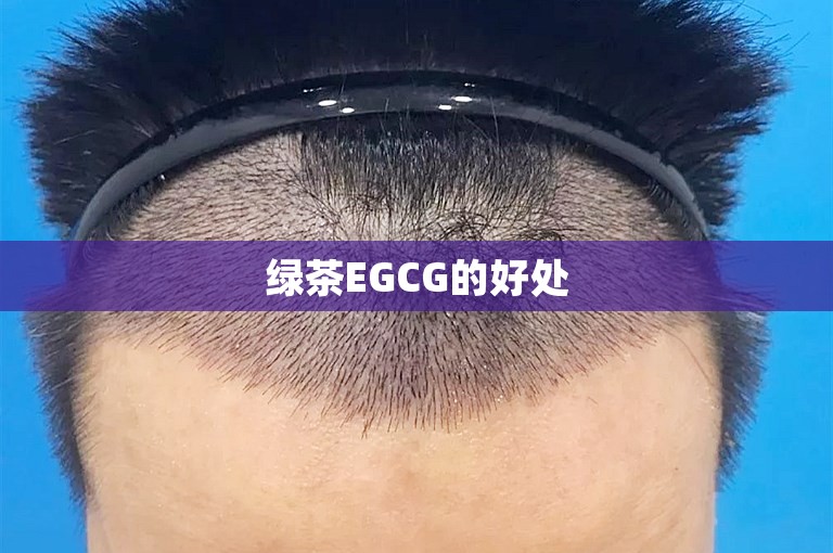 绿茶EGCG的好处