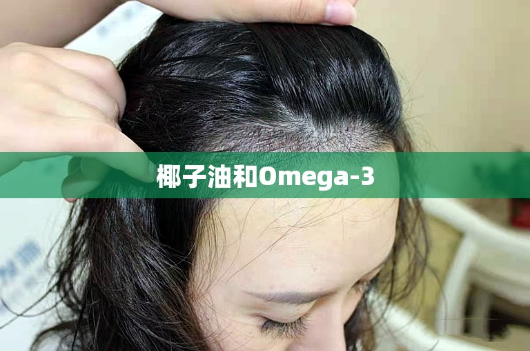 椰子油和Omega-3