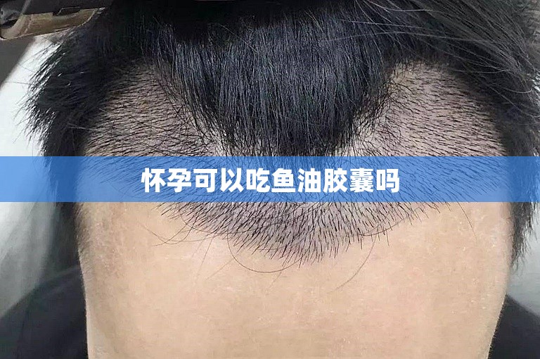 怀孕可以吃鱼油胶囊吗