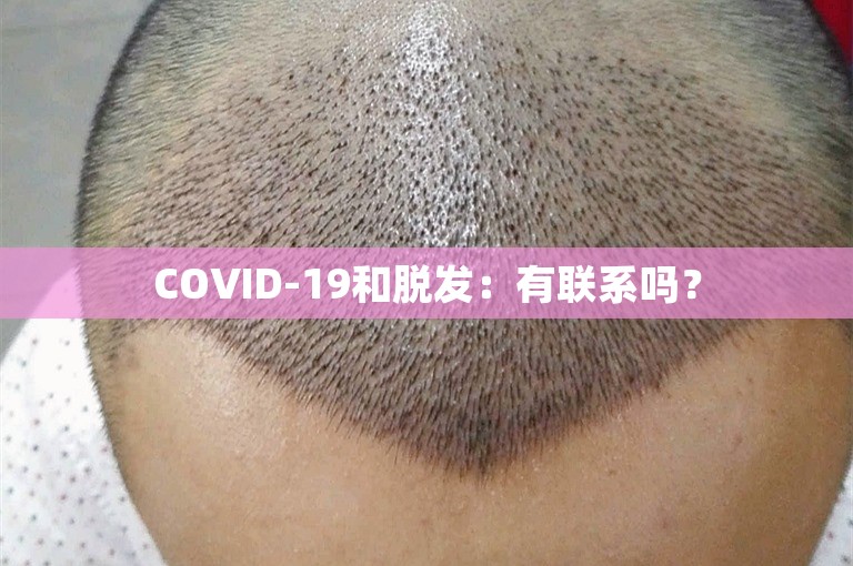 COVID-19和脱发：有联系吗？