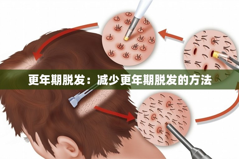 更年期脱发：减少更年期脱发的方法