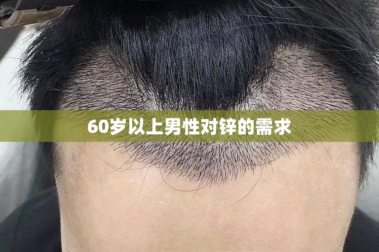 60岁以上男性对锌的需求