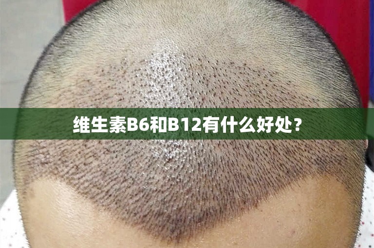 维生素B6和B12有什么好处？