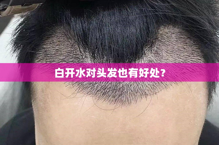 白开水对头发也有好处？