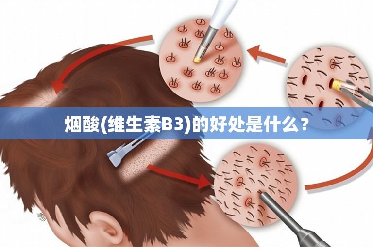 烟酸(维生素B3)的好处是什么？