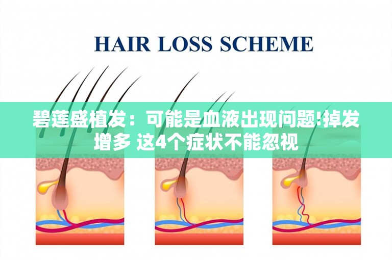 碧莲盛植发：可能是血液出现问题!掉发增多 这4个症状不能忽视