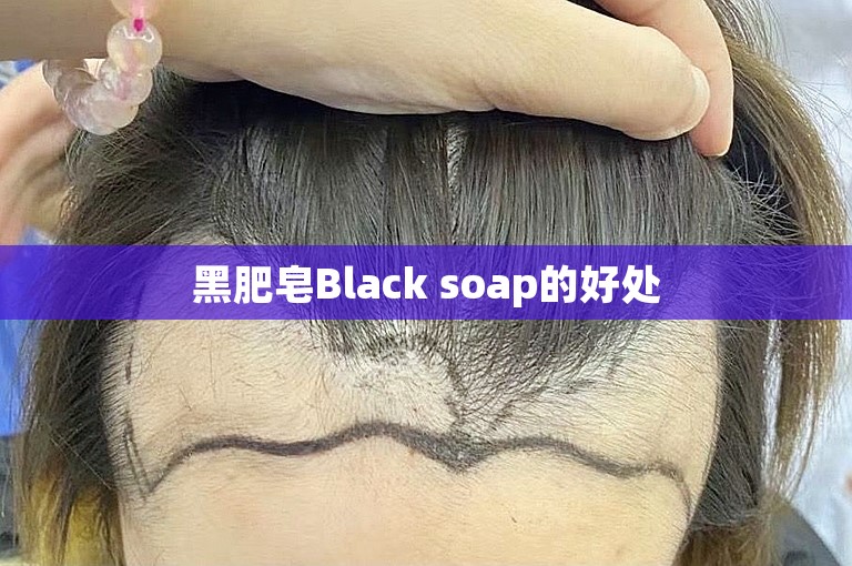 黑肥皂Black soap的好处