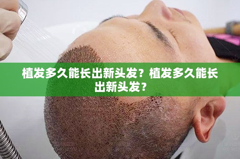 生物素对预防男性脱发至关重要吗