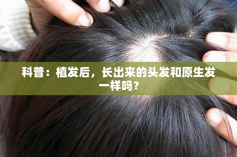 建立皮肤屏障的神经酰胺，有效防止脱发？