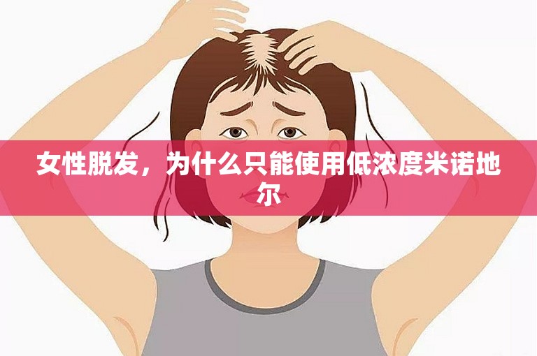 女性脱发，为什么只能使用低浓度米诺地尔