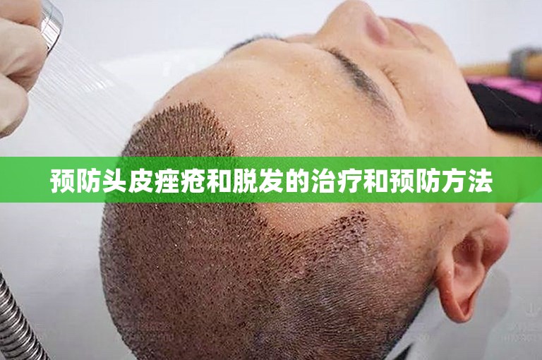 预防头皮痤疮和脱发的治疗和预防方法