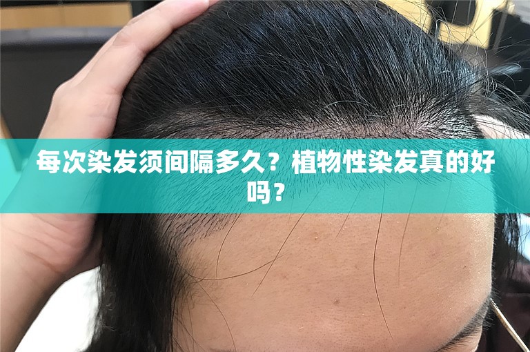 每次染发须间隔多久？植物性染发真的好吗？