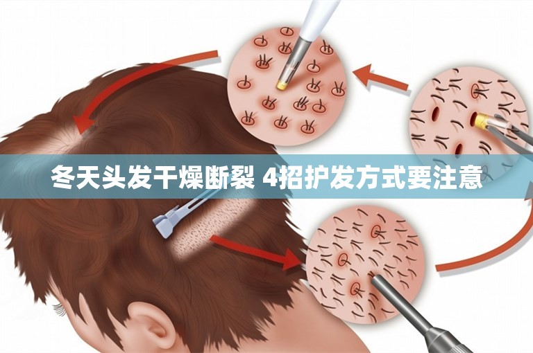 冬天头发干燥断裂 4招护发方式要注意