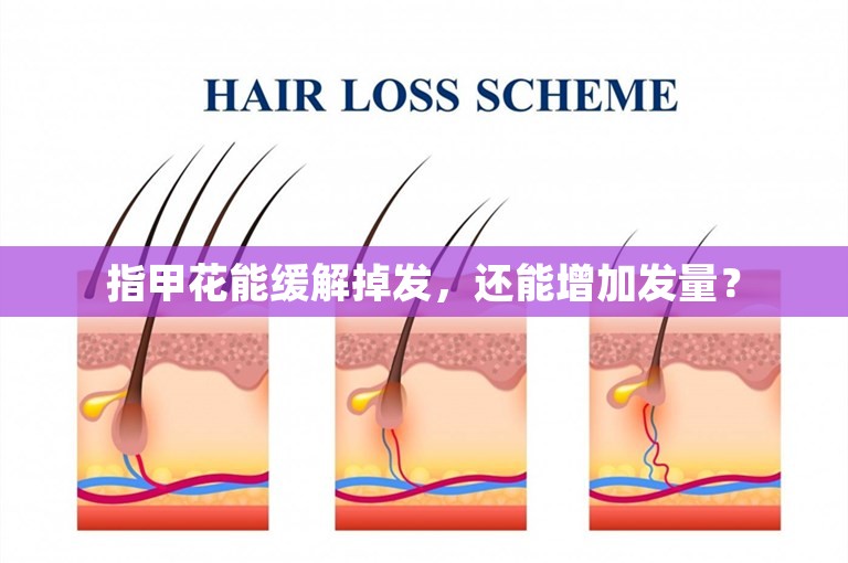 指甲花能缓解掉发，还能增加发量？