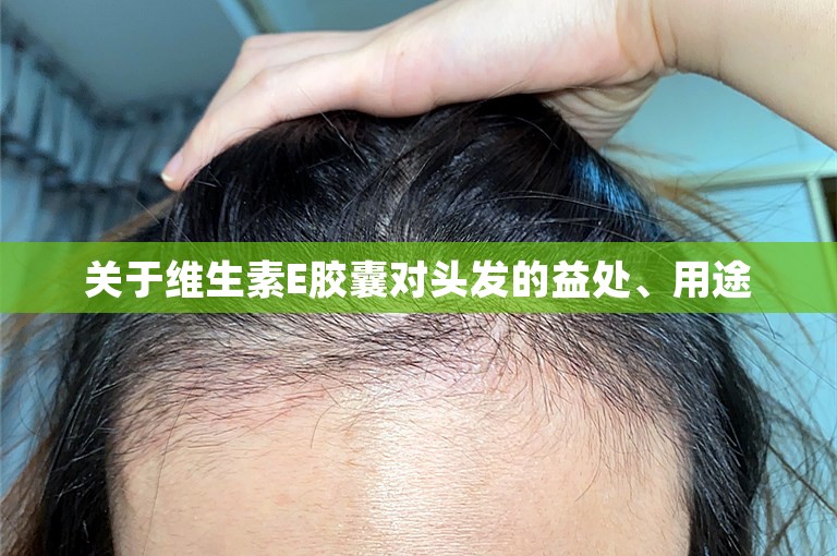 关于维生素E胶囊对头发的益处、用途