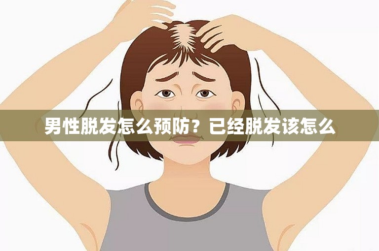 男性脱发怎么预防？已经脱发该怎么