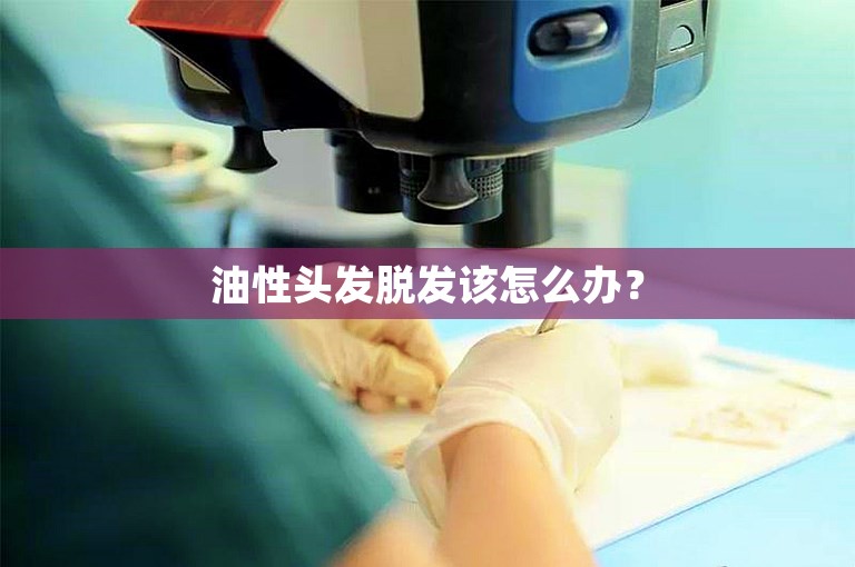 油性头发脱发该怎么办？