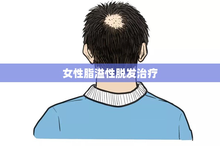 女性脂溢性脱发治疗