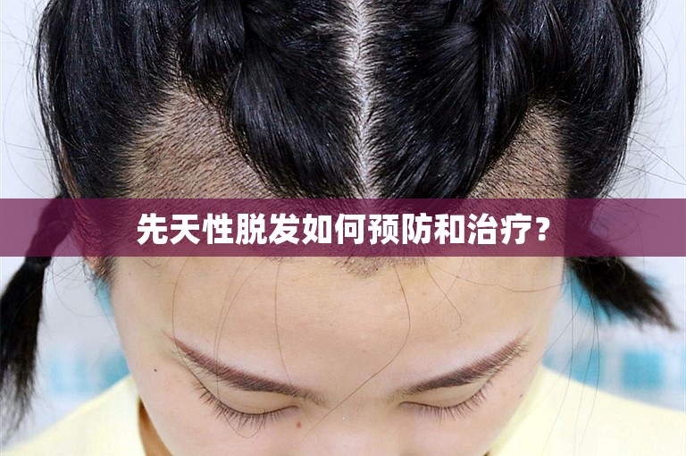 先天性脱发如何预防和治疗？