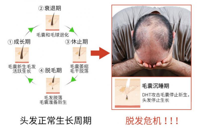 日本Mongoryu蒙琉Deeper生发育发精华液