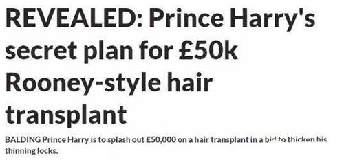 哈里王子要花45万做植发手术英国王室震惊