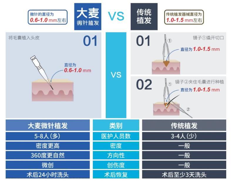 这些脱发类型你都了解吗？哪些通过植发改善？