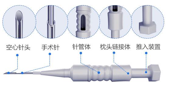 植发是什么原理，带大家了解一下