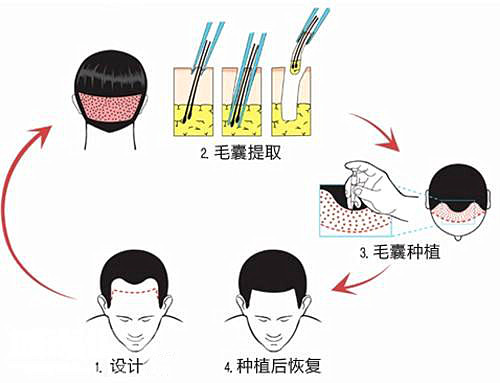 种头发医院哪家好