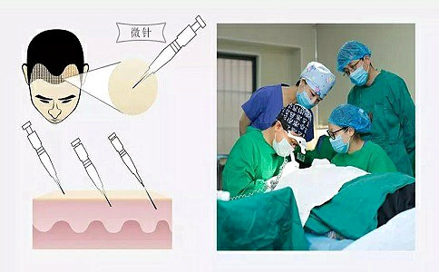 南京植发医院哪家比较好？