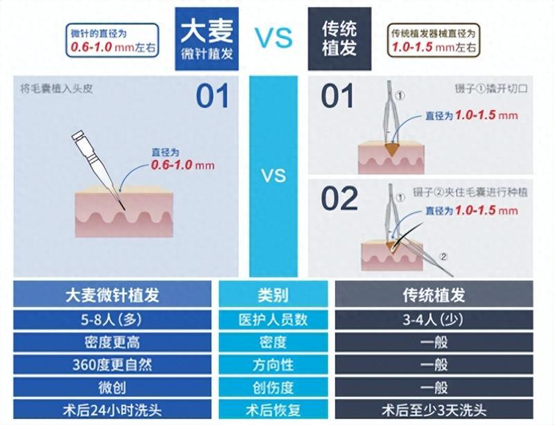 “改善性”植发需求提升,大麦植发凸显“针”功夫