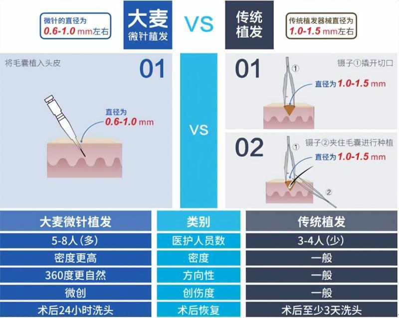 打造高级“氛围”美？大麦植发了解一下！