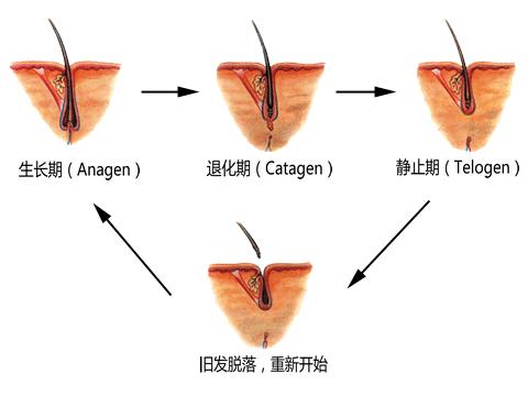 植发一个月，头发疯狂掉落，原因竟是它