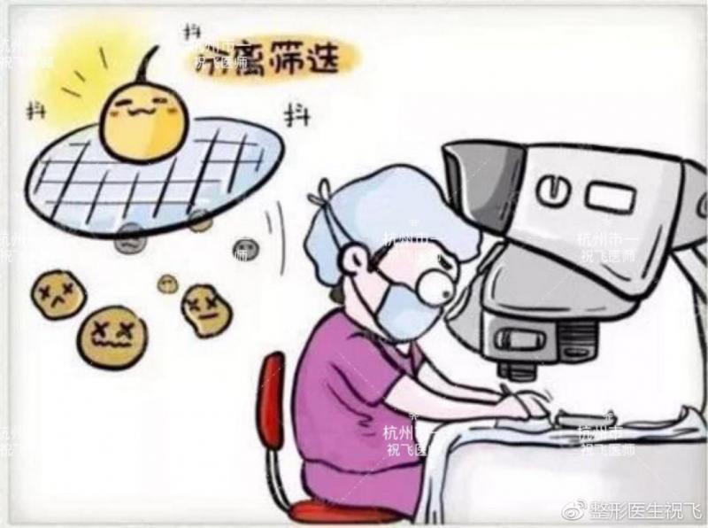杭州市祝飞医生讲解FUE植发手术全过程
