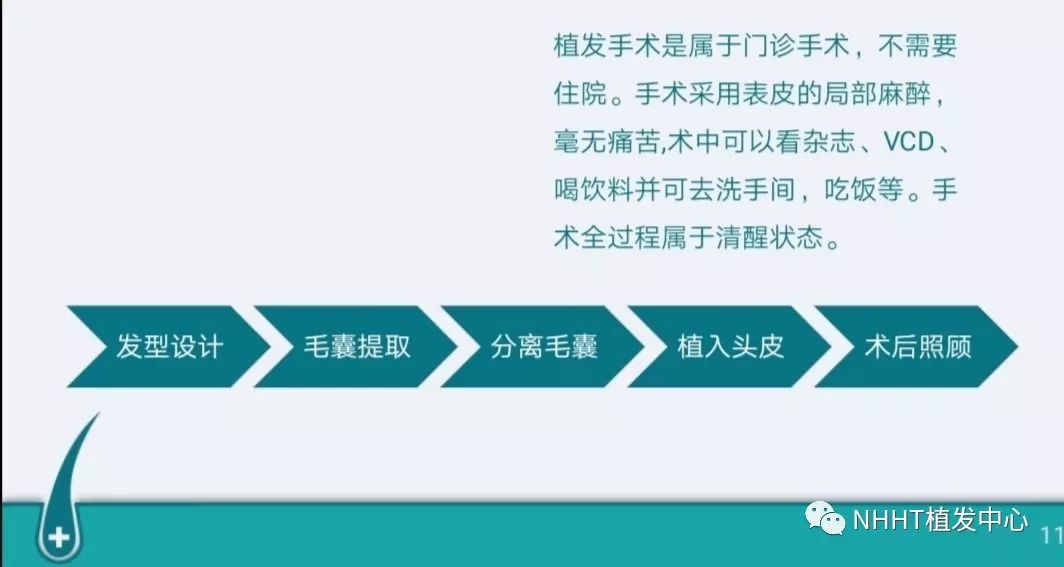 植发安全吗？忽忽不知头上事术后已是镜中人！