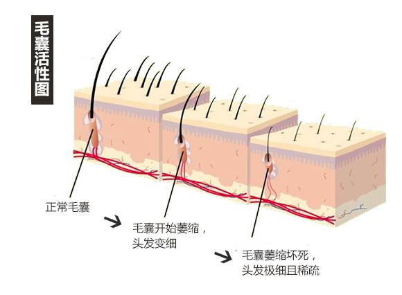 这些情况你其实可以不用植发