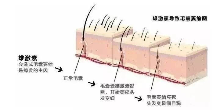 植发之前的面诊环节究竟都要做哪些工作？