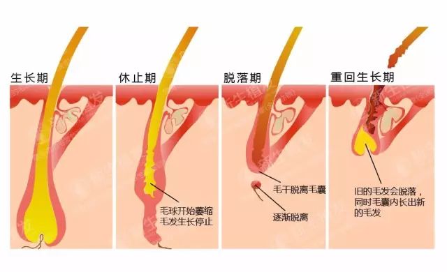 植发后多久可以长出新头发？