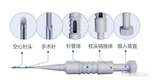 微针植发和普通植发的区别选择微针植发的几大理由