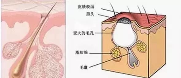 植发后1个月，我还在掉头发…